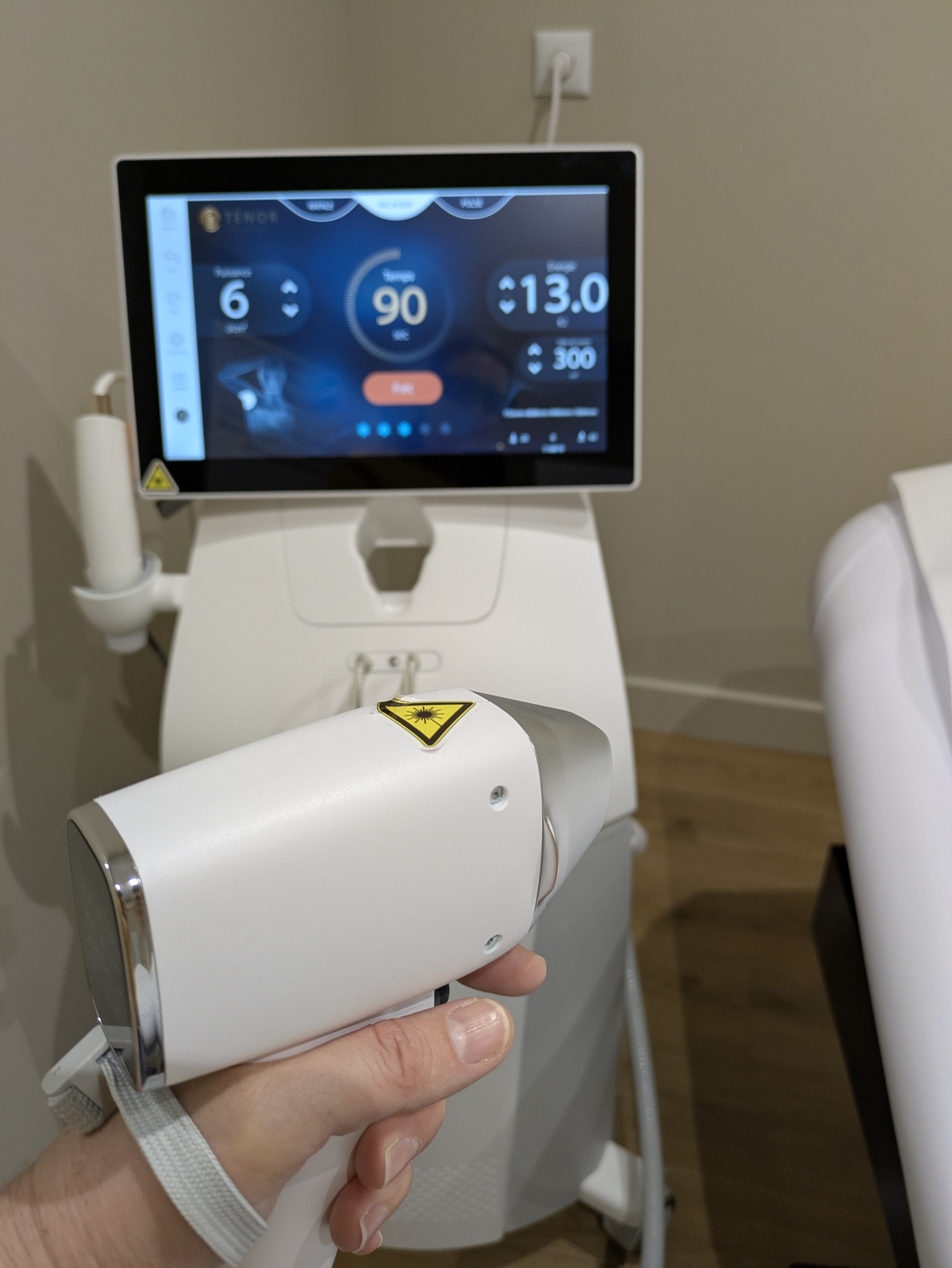 Épilation laser femme